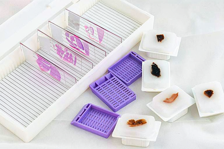 Histology tissue processing